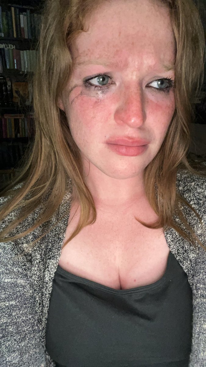 in case anyone was wondering, nothing has changed in my life. here we have me at 21 in 2018 during brallie’s death. followed by me today at 27 after the death of my next hyperfixation ship (jiara on obx). might retire from fangirling now this shit is painful