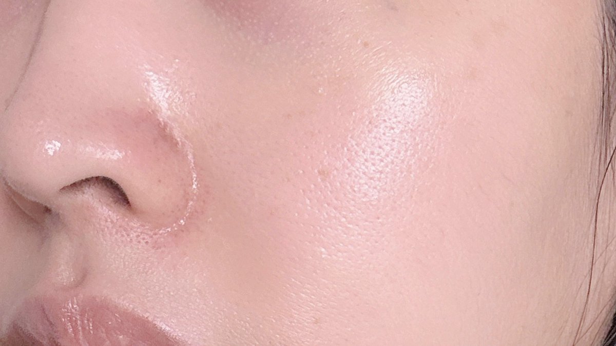 SKINTIFIC AHA BHA PHA LHA Peeling ผลัดผิว ผิวเรียบเนียนหนทางสู่ผิวกระจก🥹✨ ปล.วิใช้แค่กลางคืน อาทิตย์2-3 ครั้ง 3-4หยดลงบนหน้าที่แห้ง เริ่มใช้อาจจะไว้แค่1นาทีก่อน ใช้ไปซักพักค่อยเพิ่มเวลา แต่มากสุด5 นาทีพอ แล้วล้างออก วิมาส์กหน้า+โบกมอยส์ต่อ ผิวใสเรียบเนียน ช่วยลดสิวหัวดำที่จมูกดี รูขุมขนไม่กว้าง