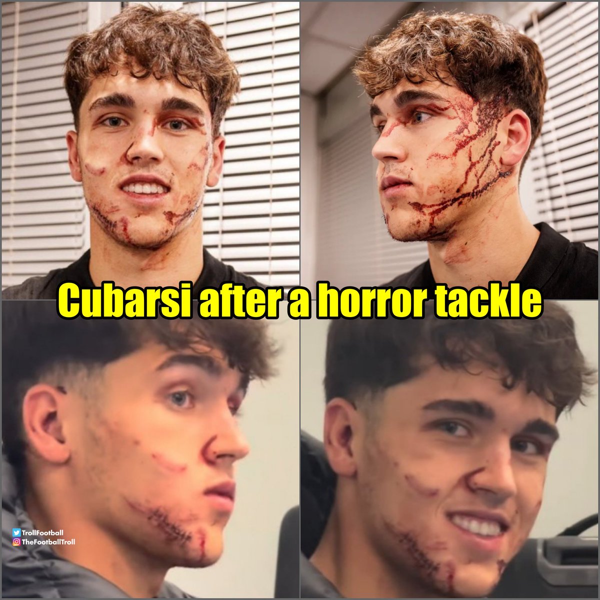 Vinicius vs Cubarasi
