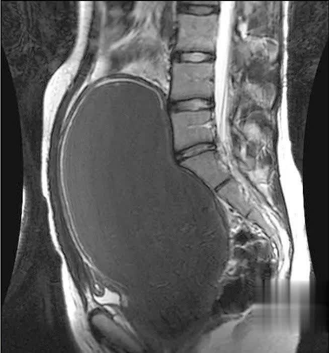 IhabFathiSulima's tweet photo. What is the diagnosis?
Clue teenager no periods. https://t.co/KkmALKQgNA