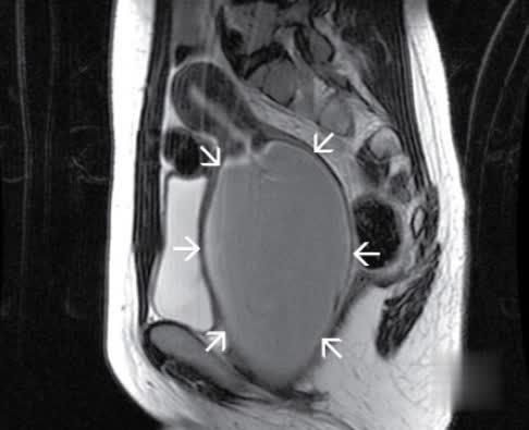 IhabFathiSulima's tweet photo. What is the diagnosis?
Clue teenager no periods. https://t.co/KkmALKQgNA