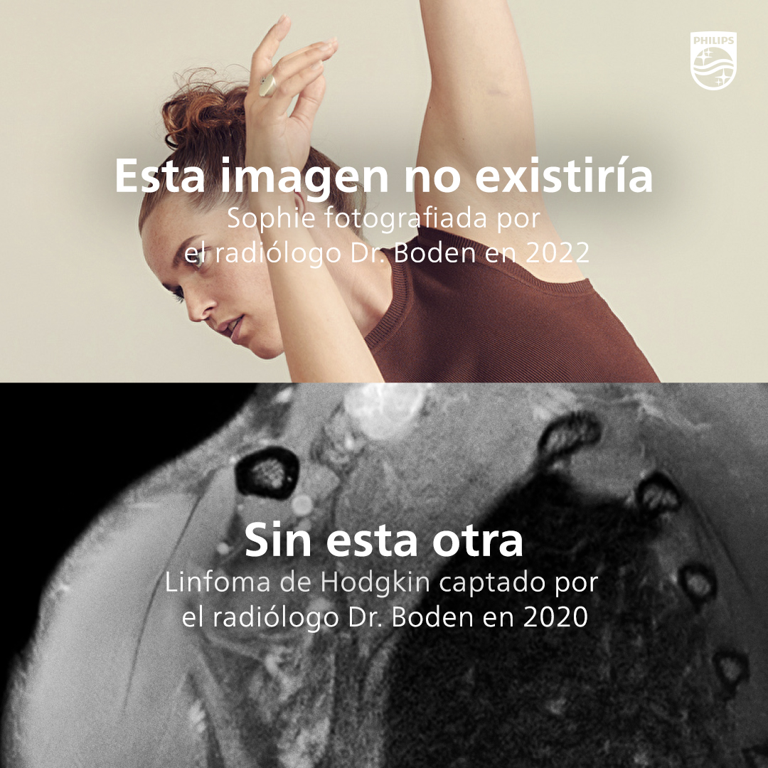 CGR_Philips's tweet photo. Para un #radiólogo que suele revisar #imágenesmédicas de pacientes, es una experiencia nueva tomar fotografías artísticas de uno de ellos. Descubre cómo un médico coge la cámara y obtiene una nueva perspectiva de un paciente https://t.co/2vHqEBFDx3

#DíaMundialRadiología https://t.co/j0IRhu9fp6