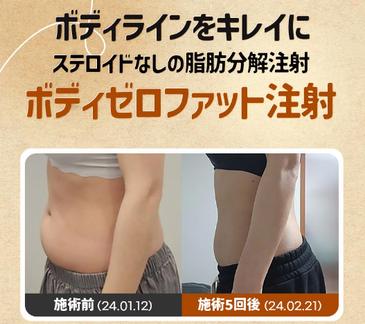 YOURCLINICJP's tweet photo. #ベンスクリニック で楽に瘦せられる⁉
運動，食事制限なしで簡単ダイエット♪

お得なイベント開催中🌟
#ゼロファット 顔1部位 290,000₩
#ゼロファット 太もも/お腹1部位 500,000₩~
#ゼロファット 太もも/お腹以外1部位 300,000₩~

イベント価格はリツイート&amp;フォローで11月以降も適用可能✨ https://t.co/sK7oKyapwC