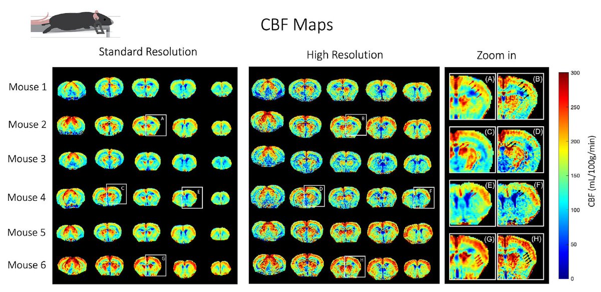 Shemesh Lab (@shemeshl) on Twitter photo Using her setup, <a href="/sara_pmonteiro/">Sara Pires Monteiro</a> showed that the CBF mapping can be done not only with higher resolution, biut also, provide much more reproducible CBF maps. 
e.g. here: Using her setup, <a href="/sara_pmonteiro/">Sara Pires Monteiro</a> showed that the CBF mapping can be done not only with higher resolution, biut also, provide much more reproducible CBF maps. 
e.g. here: