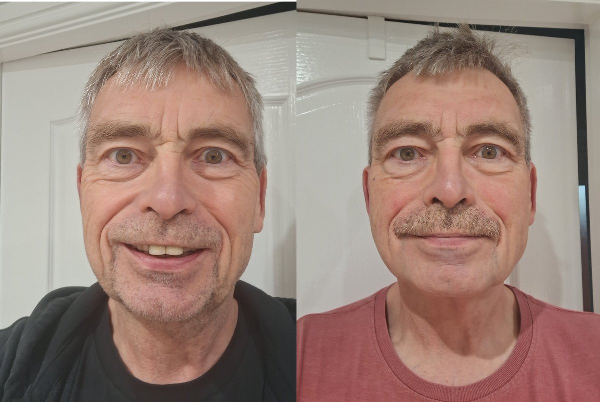 Richard Rawcliffe (@richardrawcliff) on Twitter photo I am doing <a href="/MovemberUK/">Movember UK</a> this year to raise awareness of men's health issues. Suicide is the biggest killer of young men, a scary stat. If you want to talk to somebody please call 116 123 and speak to <a href="/samaritans/">Samaritans</a> they are there to listen, JUST CALL. Also a man dies in the UK every I am doing <a href="/MovemberUK/">Movember UK</a> this year to raise awareness of men's health issues. Suicide is the biggest killer of young men, a scary stat. If you want to talk to somebody please call 116 123 and speak to <a href="/samaritans/">Samaritans</a> they are there to listen, JUST CALL. Also a man dies in the UK every