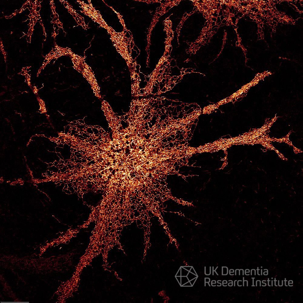 We're delighted to announce that <a href="/CecileCrapart/">Cécile</a> is the winner of our Science Imaging Competition 2024, for her amazing image 'AstrocytER' 🥳🎉👏

The endoplasmic reticulum, a network of membranes molecules move through, is stained in astrocytes, star shaped support cells

🧵1/7