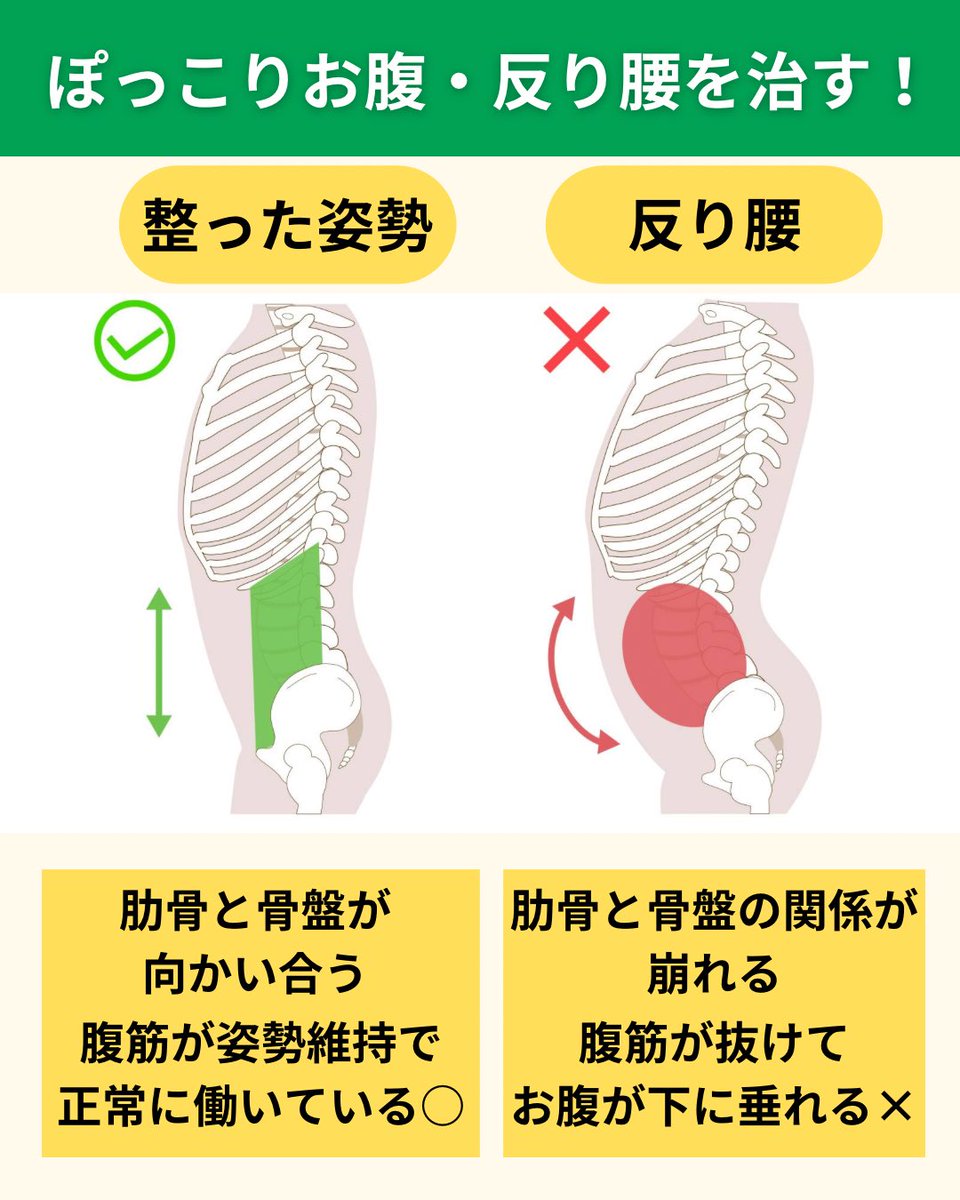 kashi_exes's tweet photo. 【ぽっこりお腹・反り腰を解消したい方へ】

原因は腰部の硬さ（圧迫）によってお腹が前方へ抜けてしまっているから。
背骨の円滑な柔軟性を取り戻すことで、反り腰は改善に向かいます。

姿勢を整えて腹筋が常時働く構造を作り、ボディラインを綺麗にしていきましょう。 https://t.co/ayFObMZivk