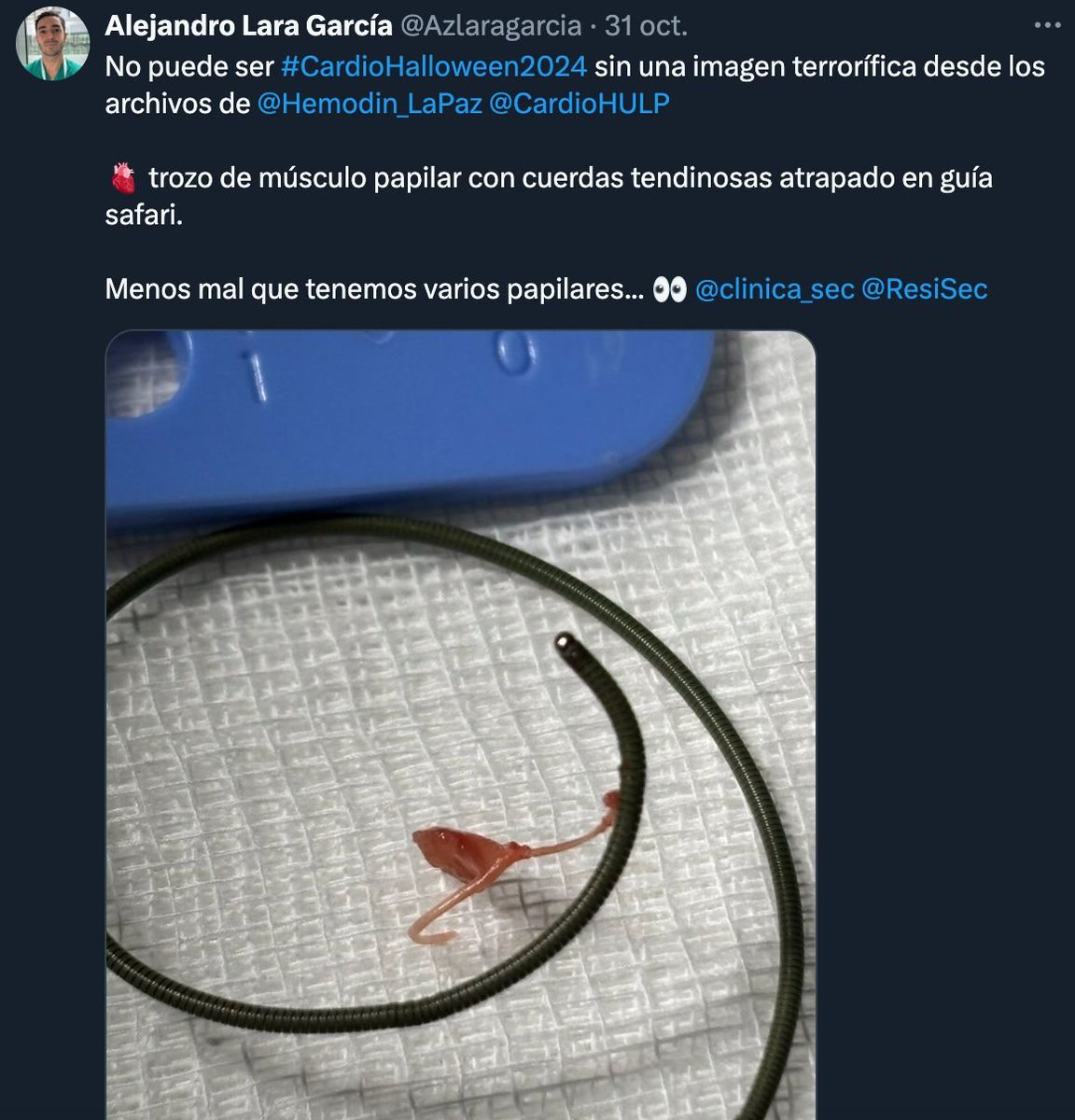 clinica_sec's tweet photo. 🥳 Ya tenemos los ganadores del Concurso de Imágenes Terroríficas #CardioHalloween 2024‼️ Empate técnico de 3 excelentes casos!
🥇@isanavarrox
🥇@Azlaragarcia
🥇@DaesubC

Muchas gracias a todos los participantes‼️#CardioClinica 👏 https://t.co/AVLNXlBssA