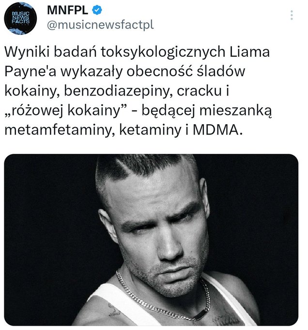 LouisWiTomo's tweet photo. @musicnewsfactpl Hej w imieniu fanów Liama proszę was o usunięcie tego wpisu i napisanie zgodnie z prawdą co znajdowało się w organizmie Liama. https://t.co/ZDcxd8cfVI