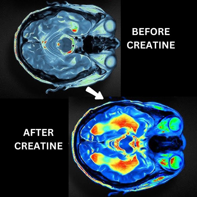 Joe le dijo recientemente a Elon

«La creatina te hace más inteligente. Ayuda a dormir. Muchos beneficios cognitivos, incluso el rendimiento cuando se carece de sueño. No hay inconvenientes, está naturalmente en los alimentos»

La creatina podría ser una razón secreta por la que