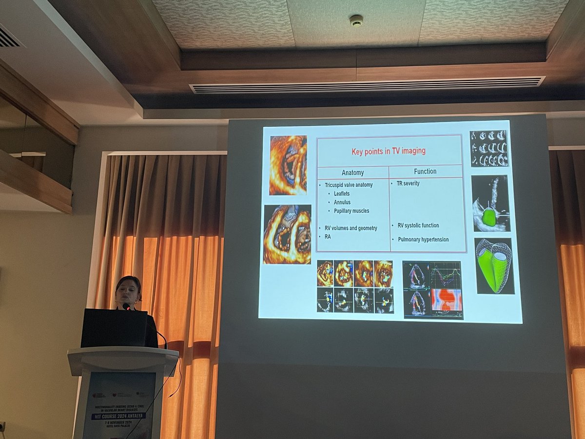 LEYLA ELIF SADE (@leylaelifsade) on Twitter photo Day 2 #eacvi HIT Course Antalya <a href="/TKDsosyal/">Turkish Society of Cardiology</a> <a href="/drozgeozden/">Özge Özden Kayhan</a> <a href="/VDelgadoGarcia/">Victoria Delgado</a> <a href="/bogdan_popescu1/">Bogdan A. Popescu</a> <a href="/NAjmoneMarsan/">Nina Ajmone Marsan</a> @esc <a href="/DonalErwan/">Donal</a> Thank you for this amazing event. Day 2 #eacvi HIT Course Antalya <a href="/TKDsosyal/">Turkish Society of Cardiology</a> <a href="/drozgeozden/">Özge Özden Kayhan</a> <a href="/VDelgadoGarcia/">Victoria Delgado</a> <a href="/bogdan_popescu1/">Bogdan A. Popescu</a> <a href="/NAjmoneMarsan/">Nina Ajmone Marsan</a> @esc <a href="/DonalErwan/">Donal</a> Thank you for this amazing event.