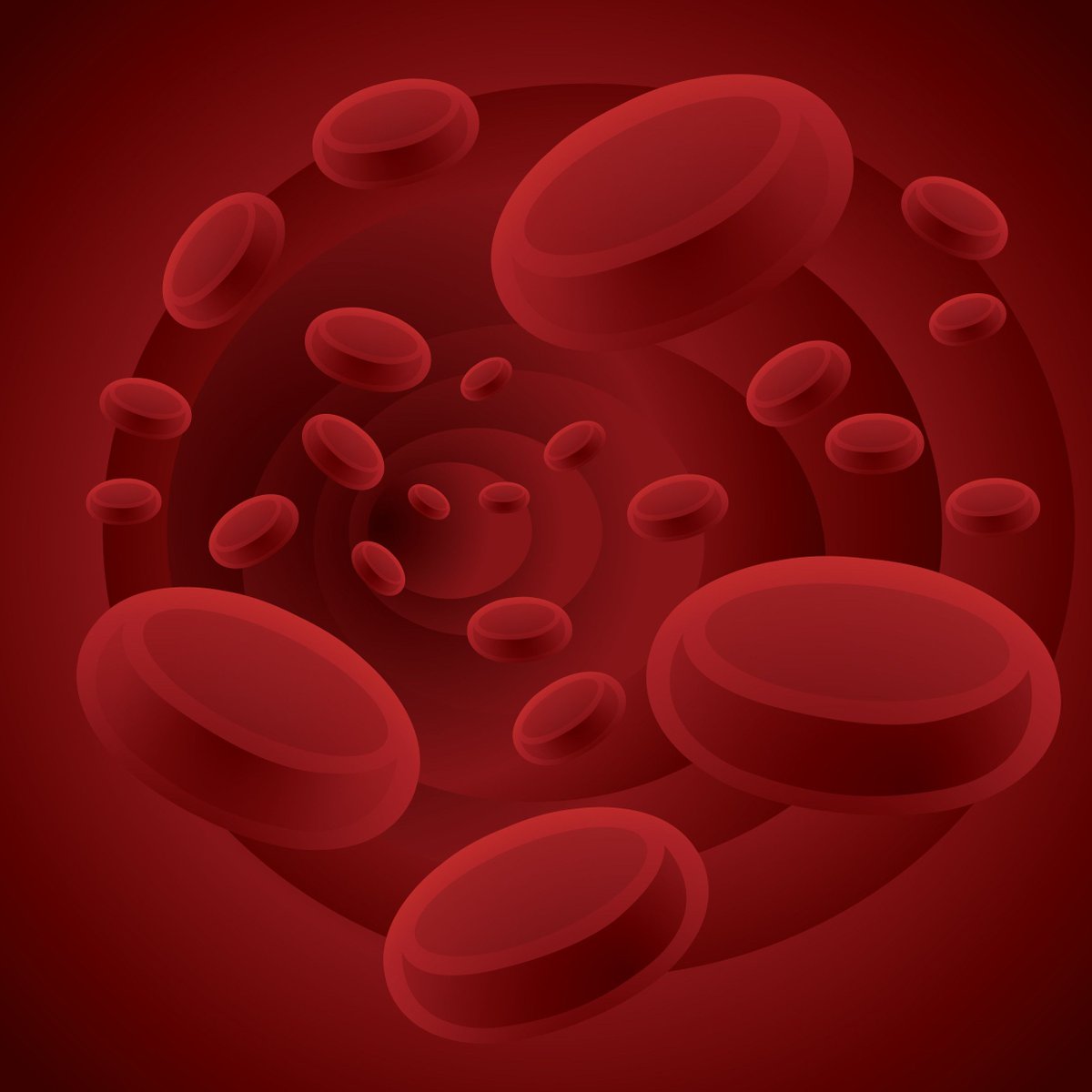 IARS_Journals's tweet photo. #Intravenous #iron for #preoperative #anemia cuts 30-day #morbidity and #mortality, boosts #hemoglobin, and reduces #transfusions—optimizing #outcomes and decreasing costs. 

#Anesthesia #TransfusionMedicine

https://t.co/Kq8GcUHCRw https://t.co/jgSgmPq2mo