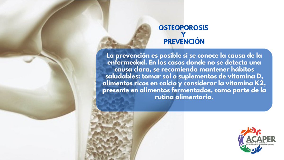 La prevención es posible si se conoce la causa de la enfermedad. 

Se recomienda mantener hábitos saludables: tomar sol o suplementos de vitamina D, alimentos ricos en calcio y considerar la vitamina K2.
#enfermedadesreumaticas #osteoporosis #somosacaper