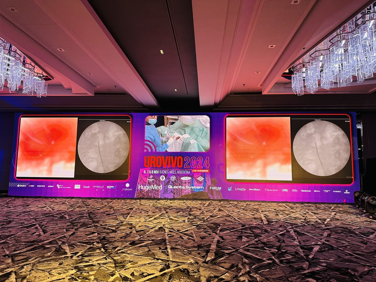 Marcelo Baptistussi (@mbaptistussi) on Twitter photo Amazing RIRS in @urovivo24 with FANS , performed by <a href="/peepeeDoctor/">Khurshid Ghani</a> !! Success!! <a href="/sproietti81/">Silvia Proietti</a> <a href="/MartinCKanne/">Martin Kanne</a> <a href="/thomaschi8/">Thomas Chi</a> <a href="/hsanguinetti/">Horacio Sanguinetti</a> <a href="/BernardoNor9/">Norberto Bernardo</a> <a href="/CAU_URO/">Confederación Americana de Urología (CAU)</a> <a href="/ResidentesCAU/">Oficina Residentes CAU</a> <a href="/Endo_Society/">Endourological Society</a> Amazing RIRS in @urovivo24 with FANS , performed by <a href="/peepeeDoctor/">Khurshid Ghani</a> !! Success!! <a href="/sproietti81/">Silvia Proietti</a> <a href="/MartinCKanne/">Martin Kanne</a> <a href="/thomaschi8/">Thomas Chi</a> <a href="/hsanguinetti/">Horacio Sanguinetti</a> <a href="/BernardoNor9/">Norberto Bernardo</a> <a href="/CAU_URO/">Confederación Americana de Urología (CAU)</a> <a href="/ResidentesCAU/">Oficina Residentes CAU</a> <a href="/Endo_Society/">Endourological Society</a>