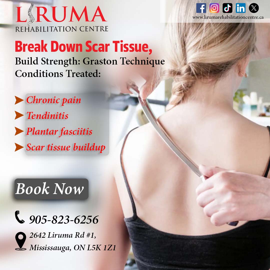 Lirumarehab's tweet image. Unlock Pain-Free Movement!

Garston Technique at Liruma Rehabilitation Centre

Book now:

𝐂𝐨𝐧𝐭𝐚𝐜𝐭 𝐮𝐬
📞        905-823-6256
✉️        liruma.clinic@yahoo.ca
🌐        lirumarehabilitationcentre.ca
📍        2642 Liruma Rd #1, Mississauga, ON L5K 1Z1, Canada

#GrastonTechnique