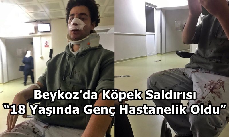 Beykoz’da Köpek Saldırısı “18 Yaşında Genç Hastanelik Oldu”
dogushaber.com/p10709_beykozd…