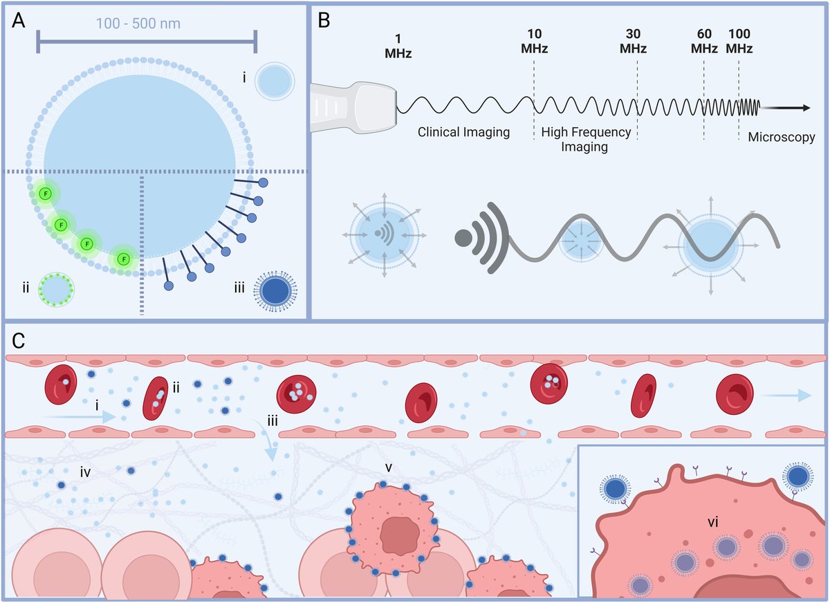 Michael Kolios (@michaelkolios) on Twitter photo Medical Imaging uses "contrast agents" to allow seeing hidden structures & spy on the symphony of molecular & cellular interactions. What agents will we have in 2124?
A tiny example: nanobubbles for ultrasound! More in new review article with <a href="/AgExner/">Agata Exner</a> 👇
dx.doi.org/10.1002/wnan.2… Medical Imaging uses "contrast agents" to allow seeing hidden structures & spy on the symphony of molecular & cellular interactions. What agents will we have in 2124?
A tiny example: nanobubbles for ultrasound! More in new review article with <a href="/AgExner/">Agata Exner</a> 👇
dx.doi.org/10.1002/wnan.2…