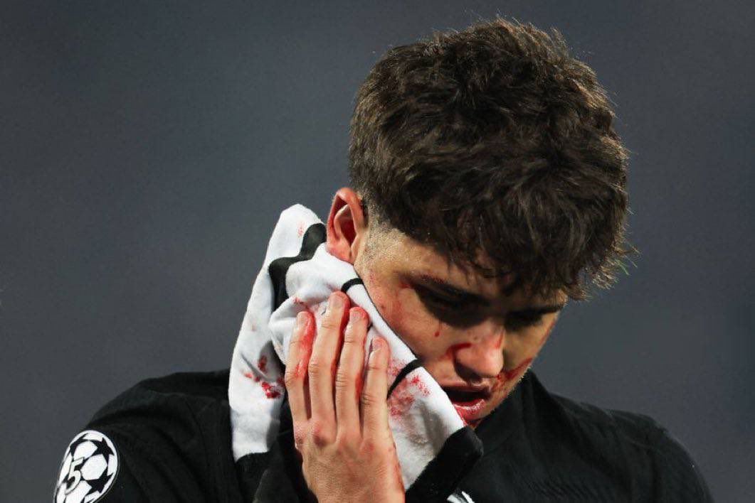 Barca_Buzz's tweet photo. ❗️Pau Cubarsí wants to play against Real Sociedad on Sunday and has asked Barcelona to find him a mask that would allow him to play by minimising the risk of the wound reopening.

Due to this request, a specialist was contacted today to see if they can find a mask for him which would prevent his wound from worsening and which not cause him discomfort and not hinder his vision.

The decision whether or not he will be included in the squad to face Real Sociedad will be made tomorrow by Hansi Flick after consulting Cubarsí himself and Dr. Pruna.
#FCB 🇪🇸

Via: @ffpolo [md]