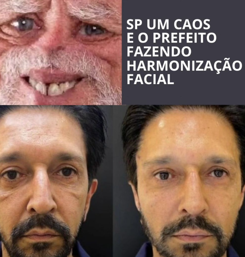 Nunes sabendo que suas propagandas maquiadas de SP deu certo, decidiu tbm dar um tapa na cara. 
Spoiler: ele continua com sua cabeça de filtro de café kkkkkk