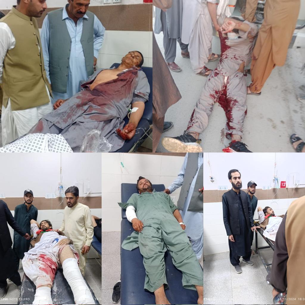 QasimKhanSuri's tweet photo. تحریکِ انصاف کے کوئٹہ جلسے کو روکنے کے لیے بلاول زرداری کی جعلی بلوچستان حکومت نے اپنے سہولتکاروں کو خوش کرنے کے لیے فسطائیت کا سلسلہ جاری رکھا، گیس شیلنگ، لاٹھی چارج اور پھر سیدھی گولیوں کے استعمال سے تحریک کے کئی کارکنان زخمی۔ 
#8Nov_Quetta_Jalsa
#UndeclaredMartialLaw https://t.co/y2915UfhAx