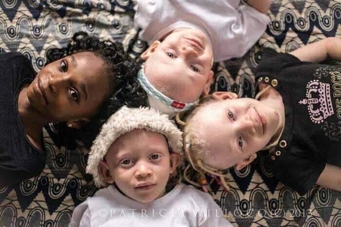 SAY_foundation_'s tweet photo. Every one of us is beautiful, regardless of our colour, race or religion. We walk under the same blue sky and breathe the same clean air. We are different shades of awesomeness!
.
#Albinism
#SameAsYou  #ChangeTheNarrative #BreakingtheLabel #Golden #AlbinismAwareness #Albino #PWA https://t.co/lz90nwZ44C