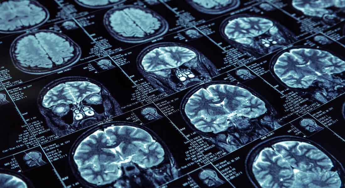 CAMH (@camhnews) on Twitter photo CAMH spin-off company Kelello Health is a measurement-based care platform transforming the delivery of #mentalhealth care.
We’re thrilled to share that Kelello Health has been awarded $100K through a competitive funding grant from <a href="/OntarioBrain/">Ontario Brain Institute</a>!🎉
MORE:
braininstitute.ca/news-events/20… CAMH spin-off company Kelello Health is a measurement-based care platform transforming the delivery of #mentalhealth care.
We’re thrilled to share that Kelello Health has been awarded $100K through a competitive funding grant from <a href="/OntarioBrain/">Ontario Brain Institute</a>!🎉
MORE:
braininstitute.ca/news-events/20…