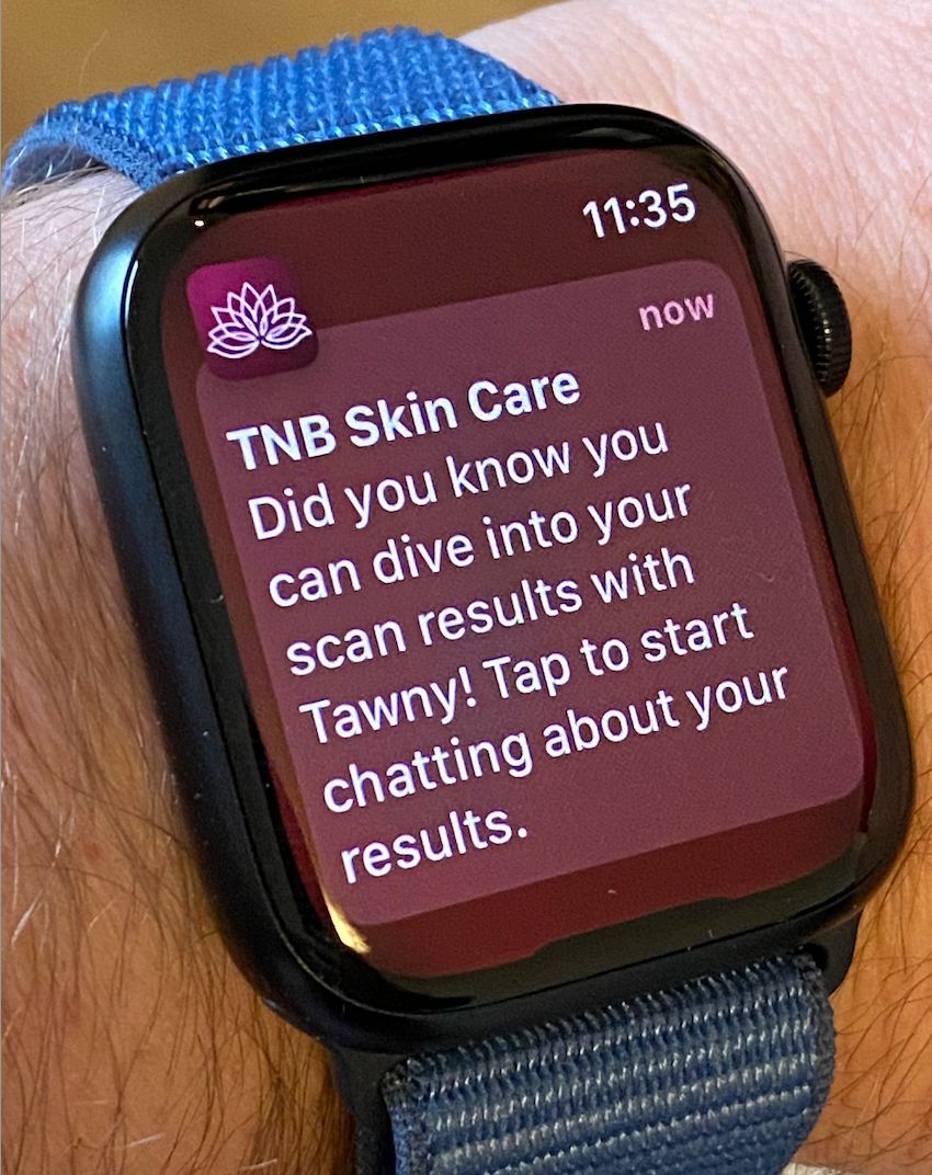 tnbskincare's tweet photo. We’re excited to share the latest TNB Skin Care app update! 🎉 Tawny, your AI skin partner, is now even smarter—offering personalized tips based on your skin scans and concerns. Download on iOS &amp; Android today or visit https://t.co/8aUJMEGvFh. #TNBSkinCare #SkinHealth https://t.co/ck1BFTtKnT