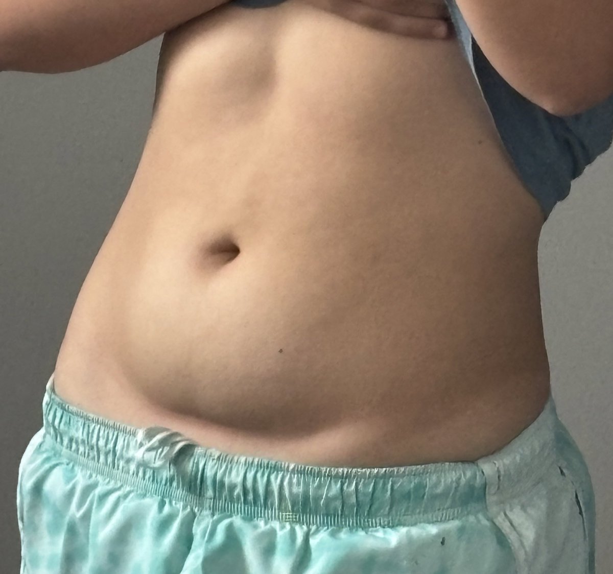 imtryingsm's tweet photo. do yall know how to get rid of this pouch??? im thanking every answer even surgery atp https://t.co/MQ9Oq4GwgE