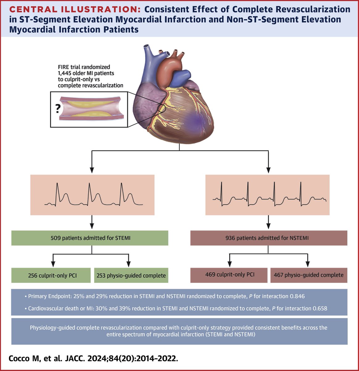JACCJournals's tweet image. Physiology-guided complete #revascularization, compared with culprit-only revascularization, provided consistent benefit across the whole spectrum of patients with MI. Get the details: bit.ly/4dEJDCx

#JACC #STEMI #NSTEMI #cvMI