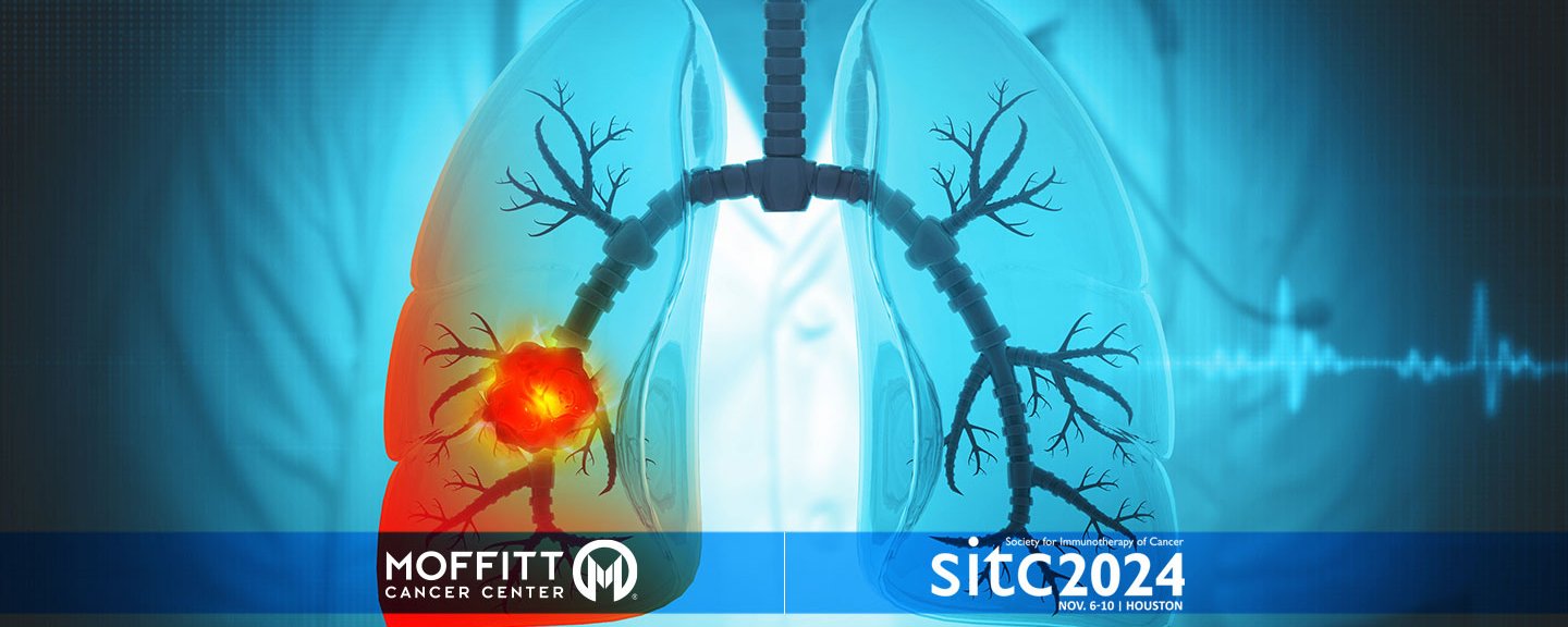 Immunotherapies For Lung Cancer Can New Combination Immunotherapy Help