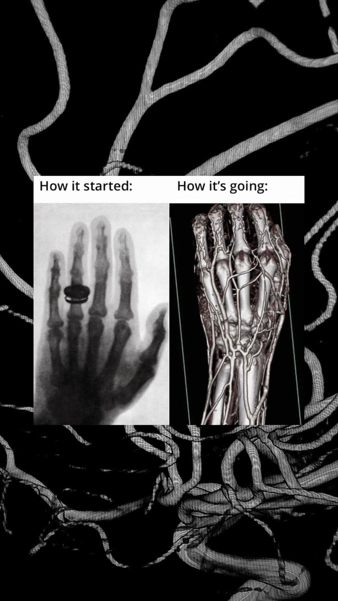 eith_i1's tweet photo. On this day in 1895, the first X-ray ever was performed by Wilhelm Roentgen.

Happy International Day of Radiology https://t.co/4RFwCuk8sa