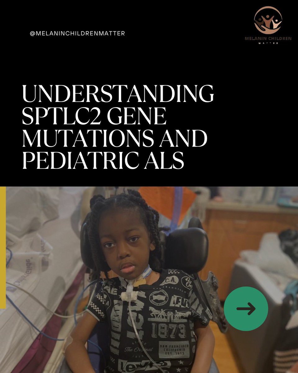 ChildrenMelanin's tweet photo. Breaking the Silence on Pediatric ALS
“Did you know that SPTLC2 mutations are linked to #ALS in children? My son’s journey has shown me how misunderstood this disease is in pediatric cases. Let’s break the silence and spread awareness! #PediatricALS #SPTLC2 #RareDisease” https://t.co/NqXYxnx73K