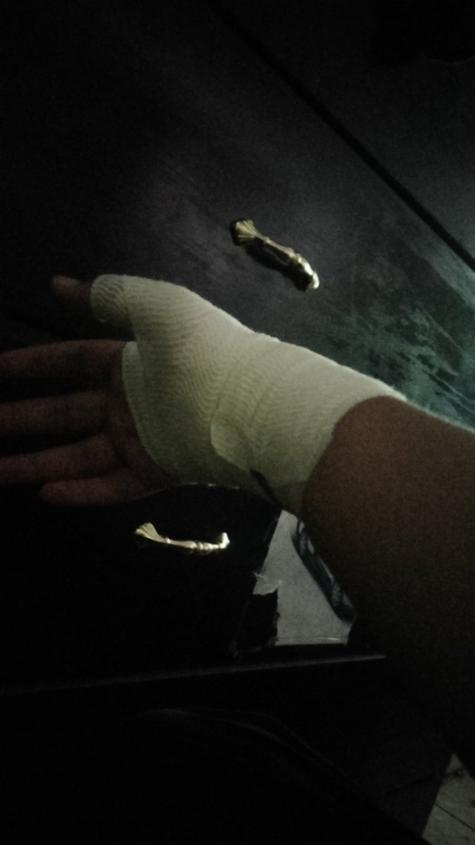 Olvidé subir lo del día 4, así que aquí un resumen rápido.
Salí en bicicleta, heche reta con los de mi barrio, me peleé con mi profe de biología y me fui temprano de la escuela

Así va mi mano
(Mi rodilla va igual que en el primer día)