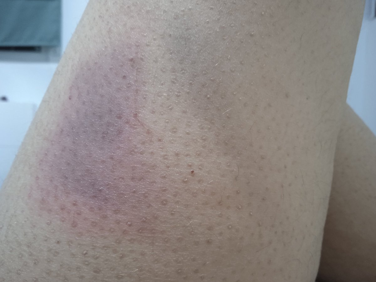 _mujer_de_'s tweet photo. No solo hay que mirar lo bajo del escote, también el largo de la falda. #asuspies https://t.co/O1QE6lSyq1