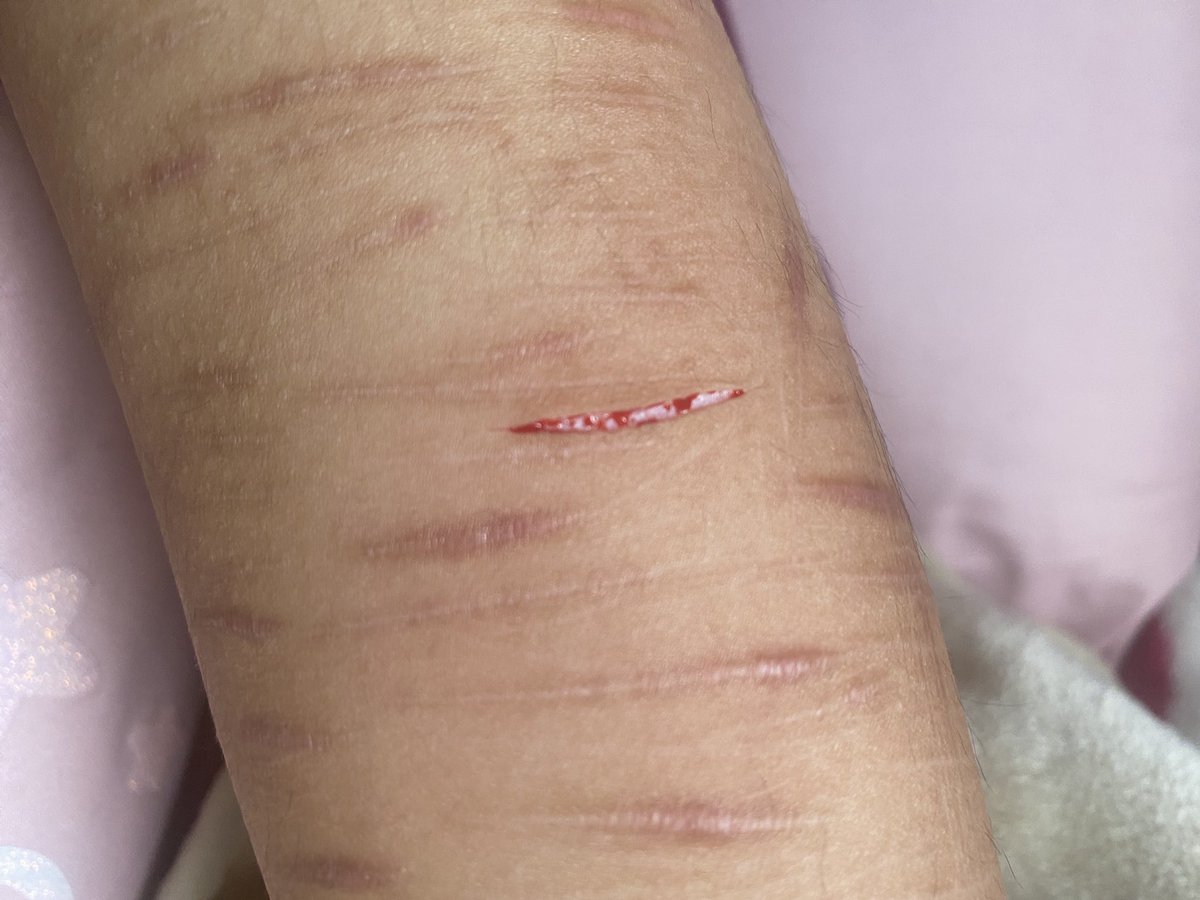 den_down0's tweet photo. Cortes de hoy:p
#sh #shtwt https://t.co/PCMkG8PKsZ