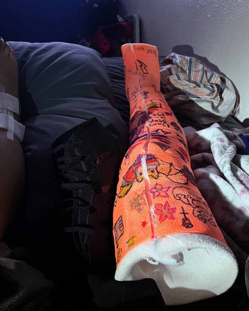 BabyDezzzy's tweet photo. Finallyyyyy #castremoval #cast #foot #feetgod #gothgirl https://t.co/8mYzYcWKRz