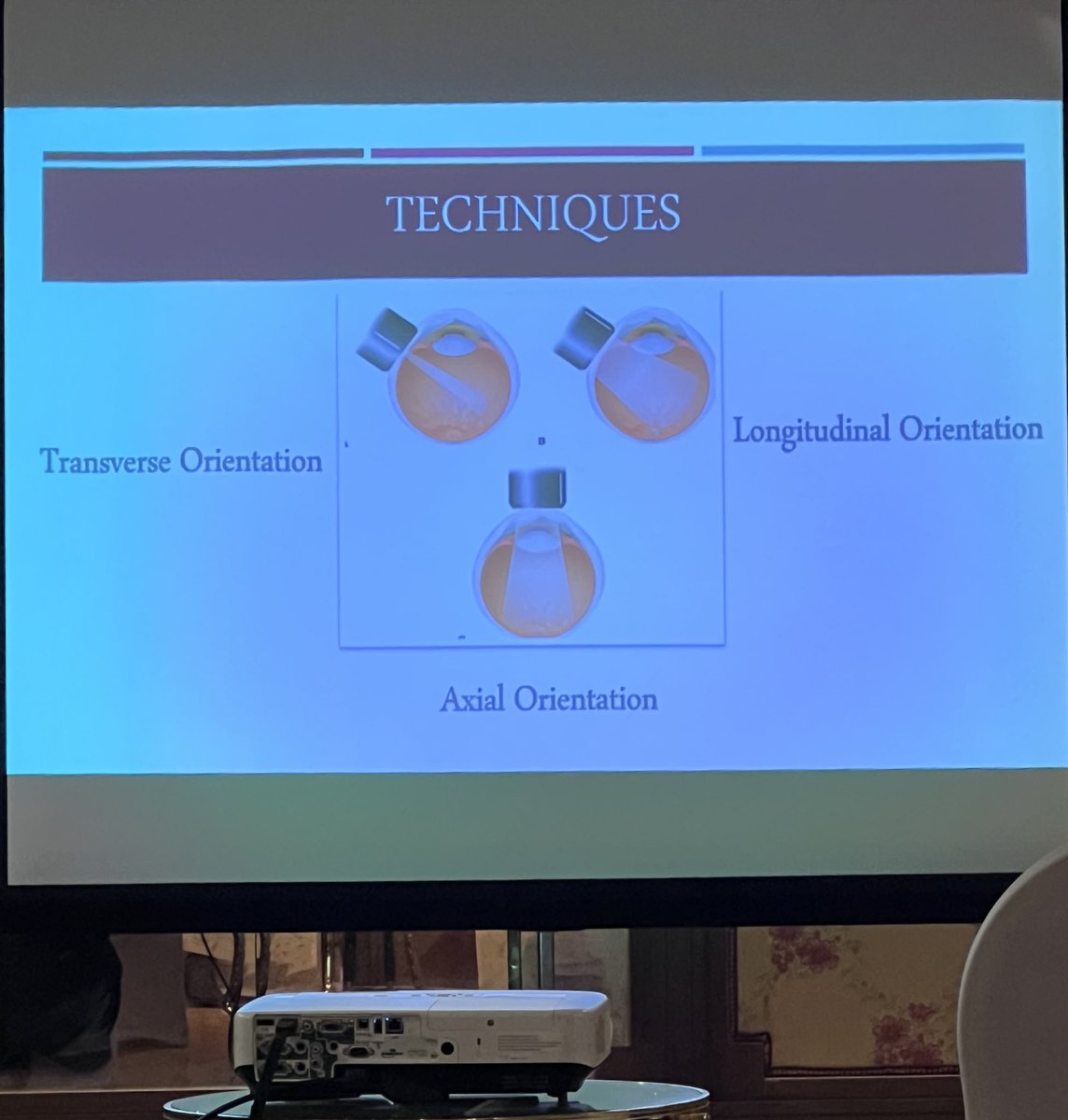 OD_Rayan's tweet image. Low Vision and Bscan / UBM
#RSOS