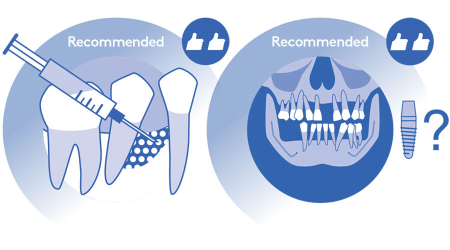 PerioEurope's tweet photo. 🆕 New EFP infographics for treating stage IV periodontitis! 

These visuals guide you through cases 1 to 4, aligning with EFP clinical practice guidelines. 

Explore them here: https://t.co/fKdv5dXbUo

#EFPerio #Periodontology #OralHealth #EFPInfographics https://t.co/63FGyqJjue