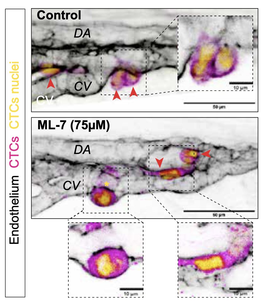 Jacky GOETZ (@goetzjacky) on Twitter photo Check out our recently-updated preprint where we dig further in the #vascular contribution to #metastatic #extravasation. #Blood vessels aren't passive barriers : they react & help, when indoctrinated.
Awesome updated work by Amandine supervised by <a href="/NaelOsmani/">Naël OSMANI</a>
#zebrafish Check out our recently-updated preprint where we dig further in the #vascular contribution to #metastatic #extravasation. #Blood vessels aren't passive barriers : they react & help, when indoctrinated.
Awesome updated work by Amandine supervised by <a href="/NaelOsmani/">Naël OSMANI</a>
#zebrafish