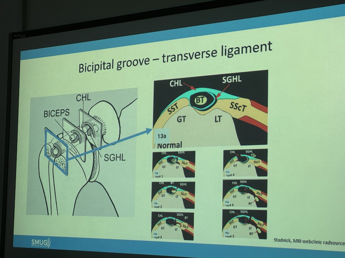 mike61668028's tweet image. Day 2 Advanced US
Upper limb #mskus #GEHeathCare