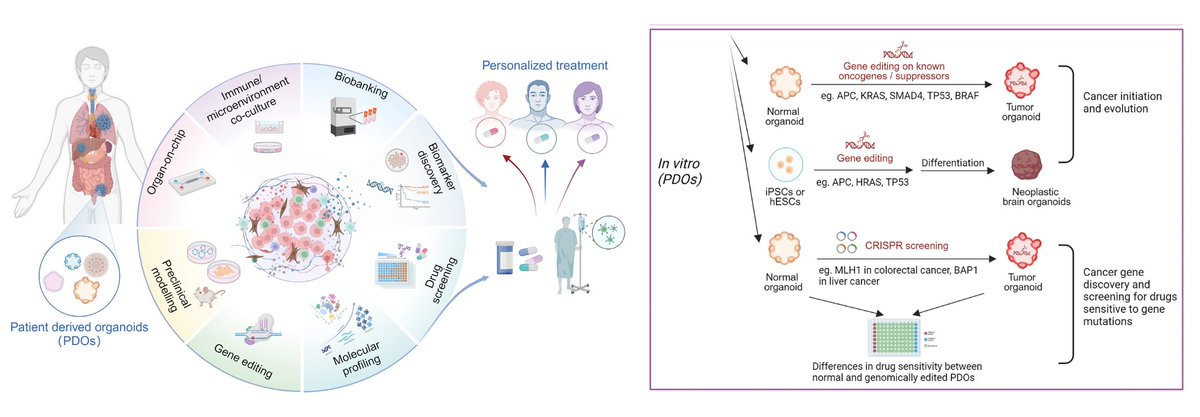 Eric Topol (@erictopol) on Twitter photo Organoids.
A super review of their role in cancer and potential to guide individualized treatment
cell.com/med/fulltext/S…
open-access <a href="/MedCellPress/">Med by Cell Press</a> <a href="/karolinskainst/">Karolinska Institutet</a> Organoids.
A super review of their role in cancer and potential to guide individualized treatment
cell.com/med/fulltext/S…
open-access <a href="/MedCellPress/">Med by Cell Press</a> <a href="/karolinskainst/">Karolinska Institutet</a>
