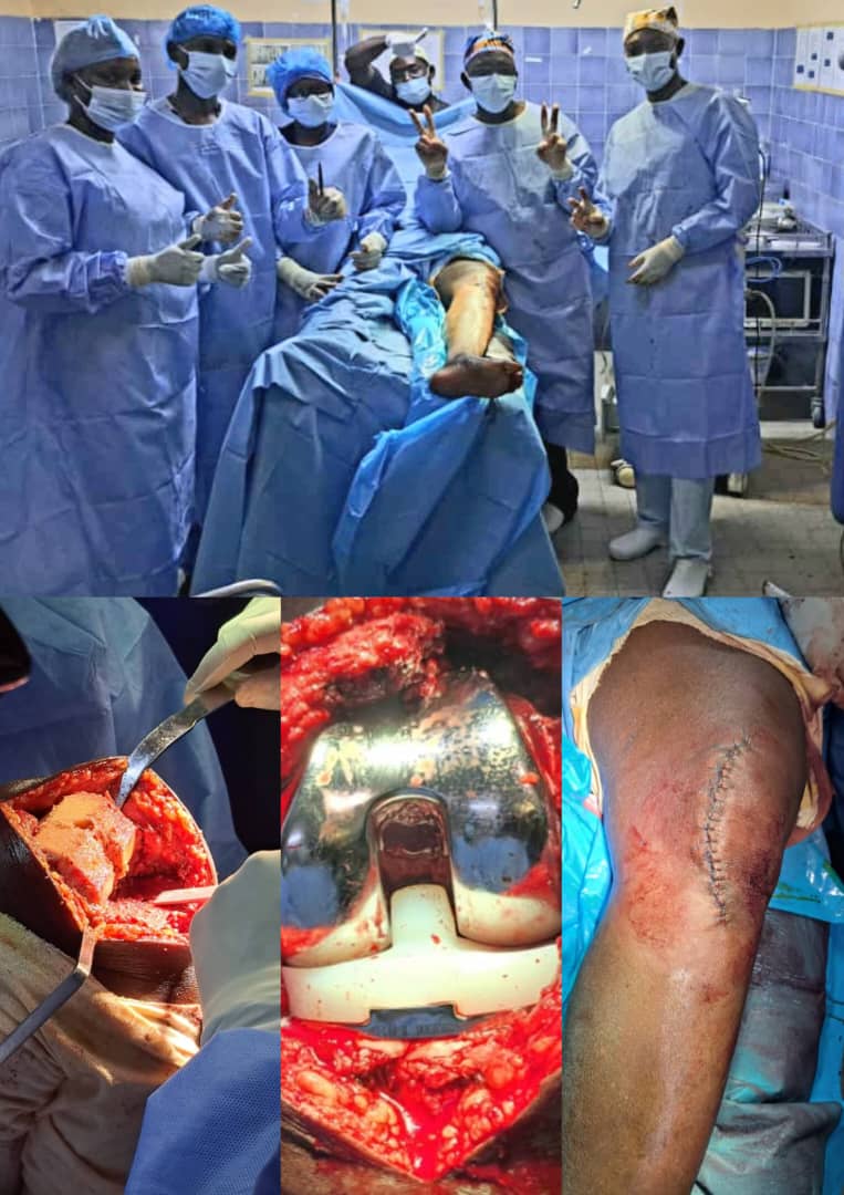 TheCameroonianZ's tweet photo. Premier cas de la prothèse totale du genou... réalisée à l'Hôpital Régional de Garoua par Dr Gaya Hamza et son équipe...

©️ : @AnneNjom #Cameroon https://t.co/W9QAwBkxuK