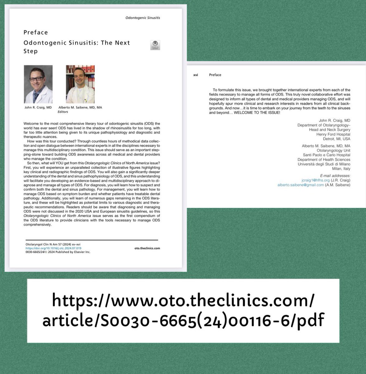 DrSujanaENT's tweet photo. Some great news this week: got my hard copy of the Dec 2024 #OCNA on #ODS guest ed by @JohnCraigNose & @ent_ams ! It’s got so much cool info. Check it out @PlasSurgENTClin @ElsevierConnect 🦷👃🏼😷
https://t.co/IMumKraix9
https://t.co/QzNWropO1U
https://t.co/WVFUlzoACn https://t.co/WQBvZZy1K4