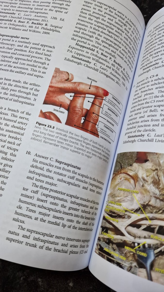 Christopher George Ghazala (@doctorghazala) on Twitter photo <a href="/PG_Orthopaedics/">PG_Orthopaedics</a> Thank you <a href="/BanasziewiczP/">Paul Banaszkiewicz</a> for giving me the opportunity to be involved. My pre-order was received today 😀 <a href="/PG_Orthopaedics/">PG_Orthopaedics</a> Thank you <a href="/BanasziewiczP/">Paul Banaszkiewicz</a> for giving me the opportunity to be involved. My pre-order was received today 😀