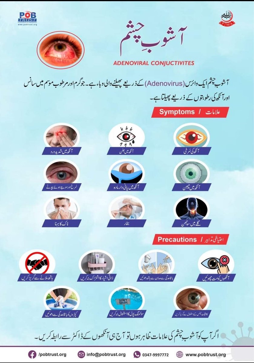 Adenoviral Conjunctivitis.. 
آشوب چشم
#optometrist #adenoviral #ainakwala