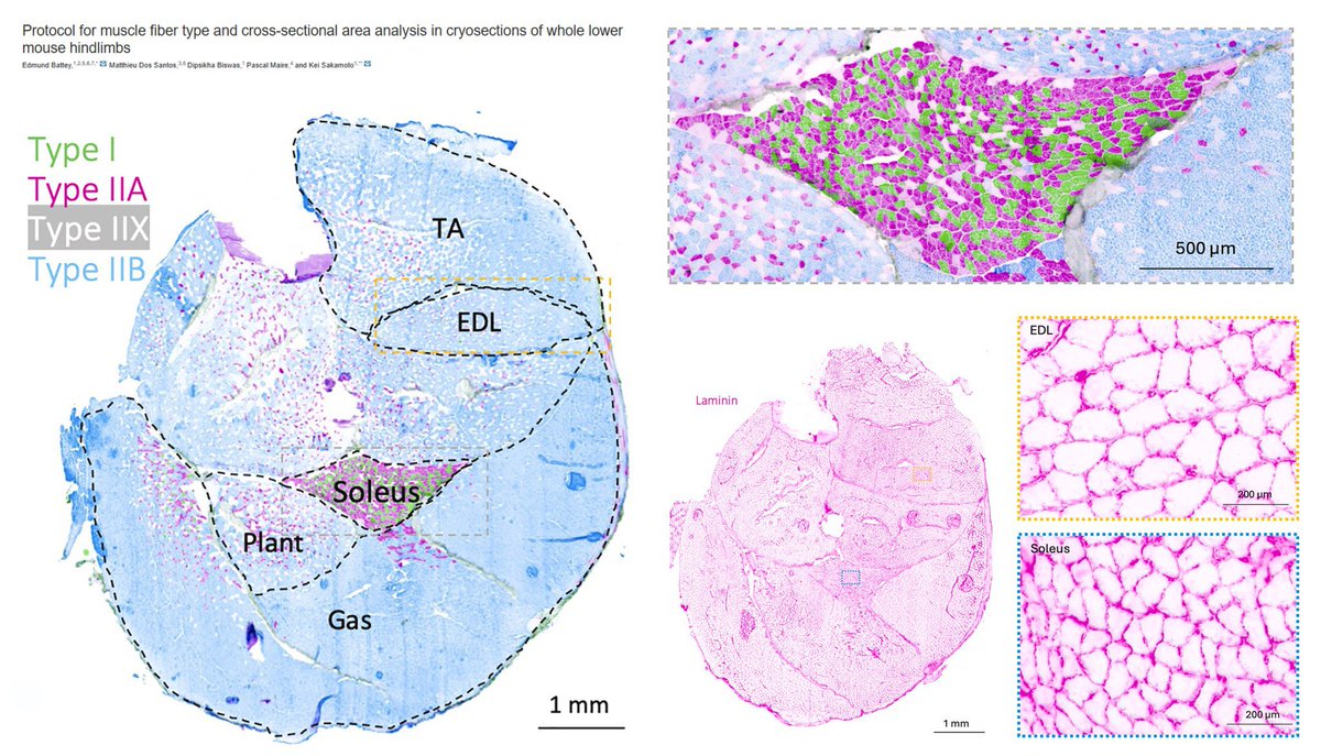 Very nice figure showing the fiber type composition of hindlimb muscles in mice. Notice the very high proportion of type IIb fibers in most muscles, a fiber type that does not exist in humans.