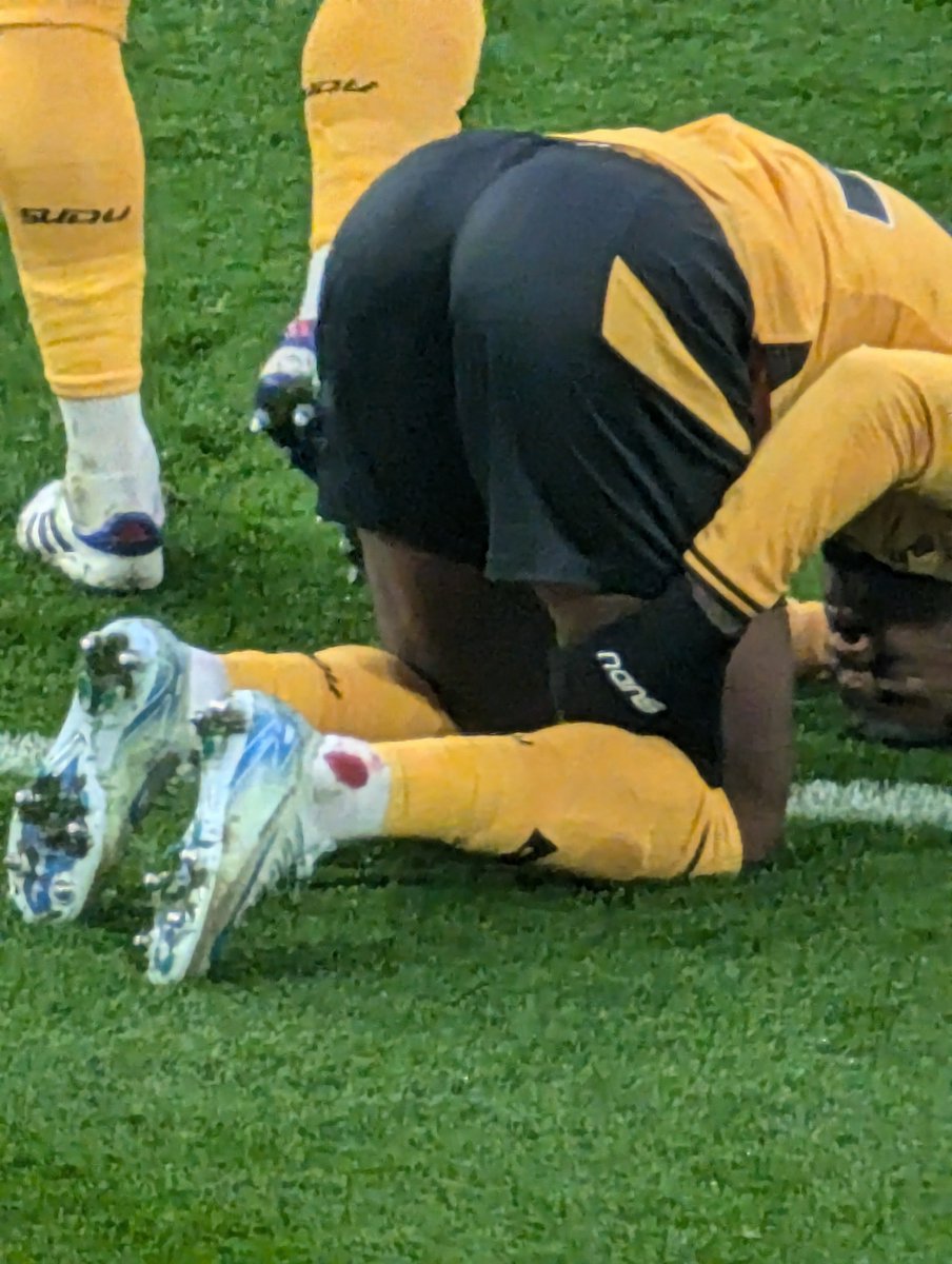 Very possible.

The bit where he ends up with a hole in his ankle. Unless you think Nelson Semedo has stigmata.