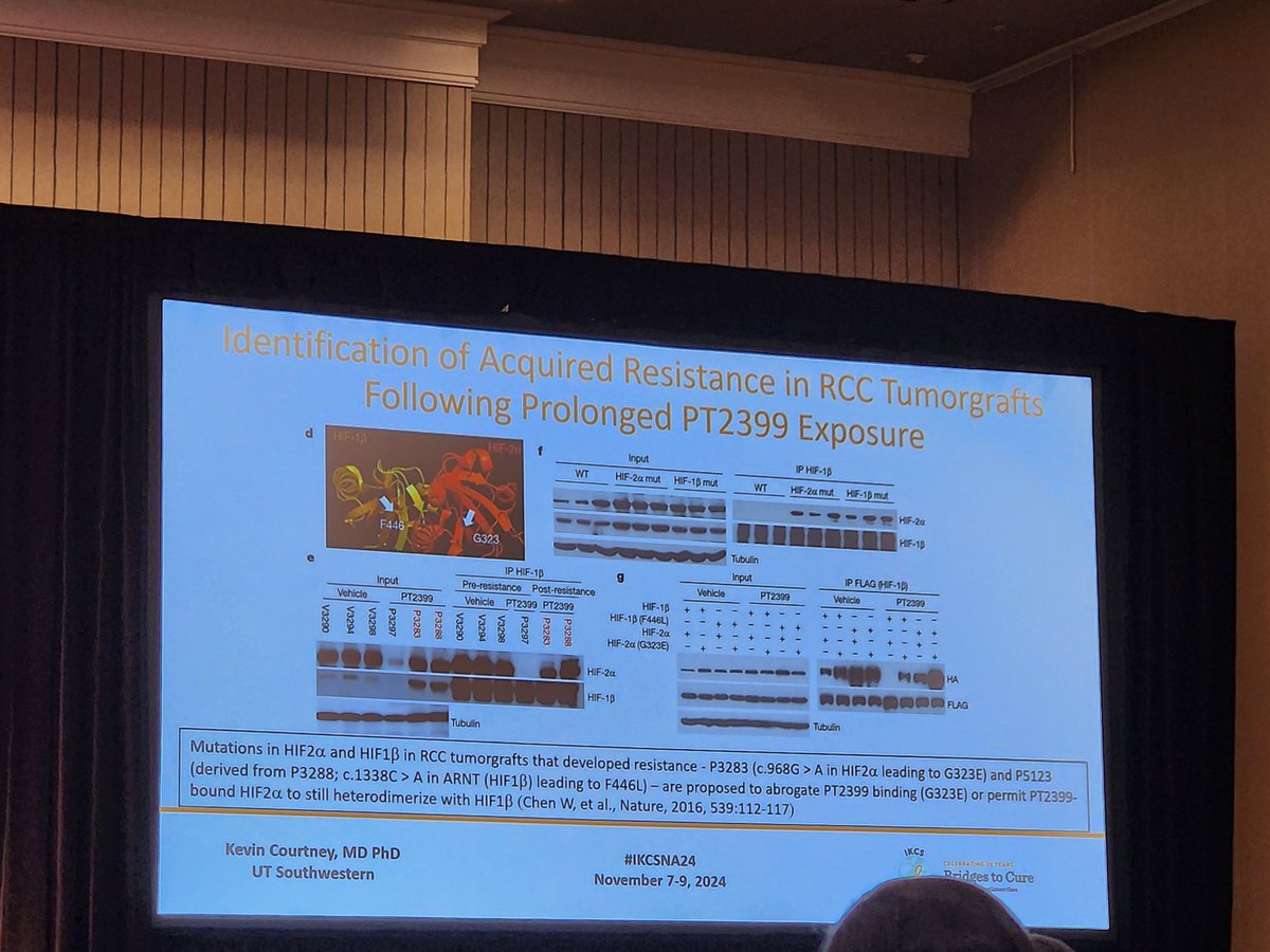 QianJanieQin (@qianjanieqin) on Twitter photo Dr. Kevin Courtney <a href="/utswcancer/">UTSW Simmons Cancer Center</a> giving eloquent overview of #hif2a inhibition, initially developed at <a href="/UTSWMedCenter/">UT Southwestern Medical Center</a>, in the treatment of #VHL and #ccRCC, diving also into resistance mechanisms and area of active research at <a href="/KCPUTSW/">KidneyCancerProgram</a> <a href="/KidneyCancer/">Kidney Cancer</a> <a href="/TiansterZhang/">Tian Zhang, MD, MHS, FASCO (@tiansterzhangmd.bsky)</a> #IKCSNA24 Dr. Kevin Courtney <a href="/utswcancer/">UTSW Simmons Cancer Center</a> giving eloquent overview of #hif2a inhibition, initially developed at <a href="/UTSWMedCenter/">UT Southwestern Medical Center</a>, in the treatment of #VHL and #ccRCC, diving also into resistance mechanisms and area of active research at <a href="/KCPUTSW/">KidneyCancerProgram</a> <a href="/KidneyCancer/">Kidney Cancer</a> <a href="/TiansterZhang/">Tian Zhang, MD, MHS, FASCO (@tiansterzhangmd.bsky)</a> #IKCSNA24