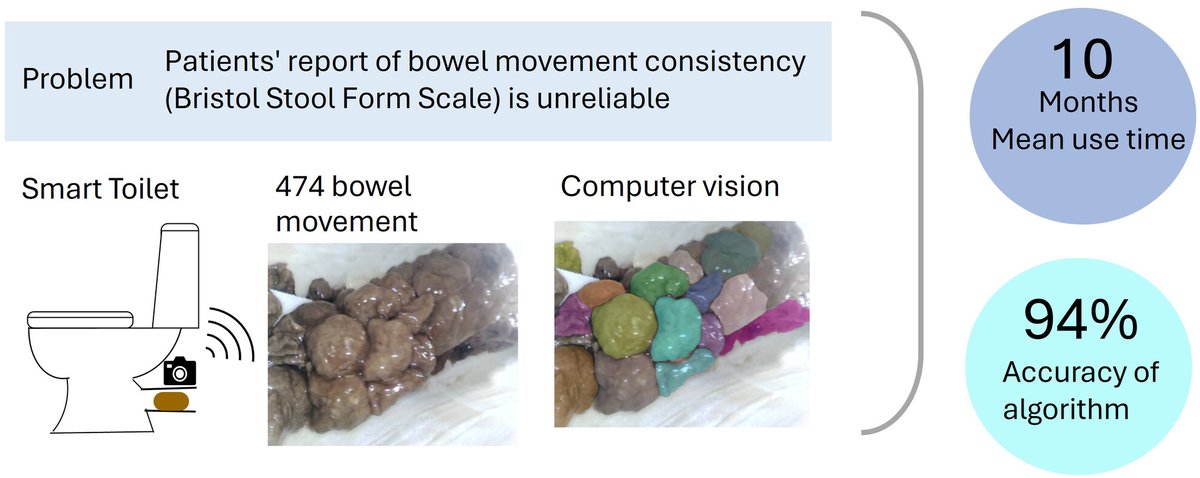 NGMJournal's tweet photo. 🆕🔥Using the novel #SmartToiletSystem supports the #feasibility & #accuracy of #long-term, non-invasive #automated #StoolForm monitoring⏩Eliminating the burden on patients to track their #Bowel forms‼️
👉https://t.co/dLJjSughSS
@ANMSociety @esnm_eu #GITwitter #MedTwitter https://t.co/UluPFxyLxb