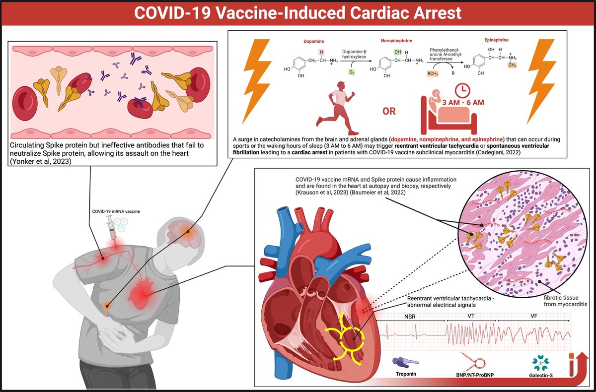 Moderna and Pfizer mRNA uptake into heart cells, leading to the production of toxic prefusion-stabilized Spike protein, explains the sharp increase in fatal cardiac arrests among the highly vaccinated population of King County, WA.

McCullough, P.; Hulscher, N. Risk